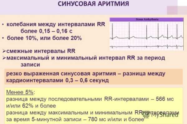 Экг описание норма образец